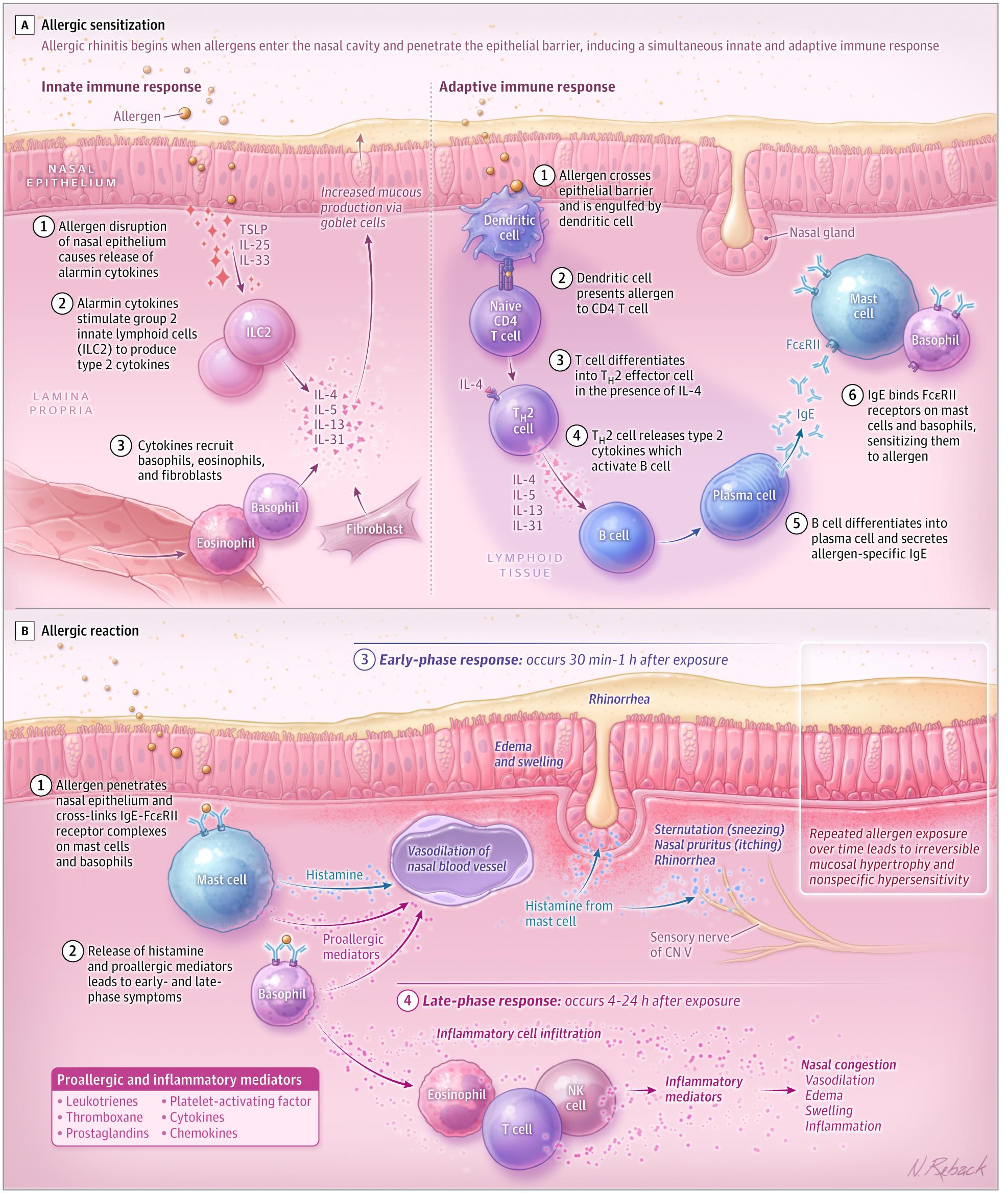 Figure 1. The Pathogenesis of Allergic Rhinitis