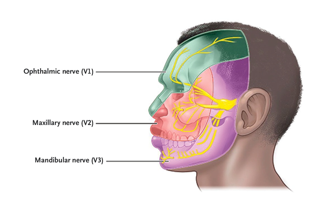 Figure 3. Branches of the Trigeminal Nerve.