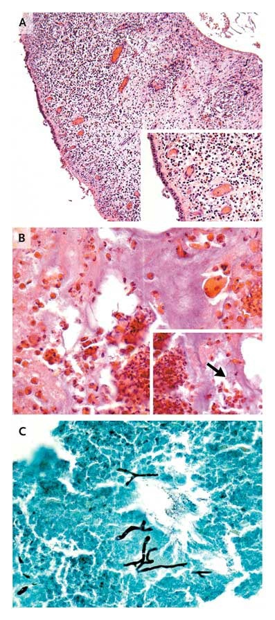 Figure 3. Sinus Contents.