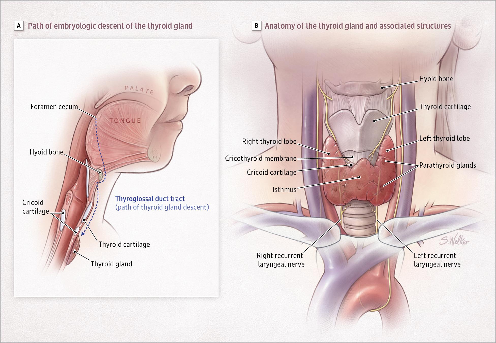 Figure 2. Path of Embryologic Descent of the Thyroid Gland and Postembryonic Neck Anatomy